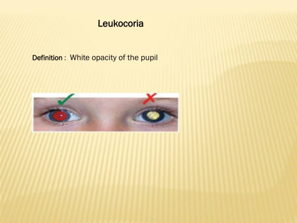 Leukocoria