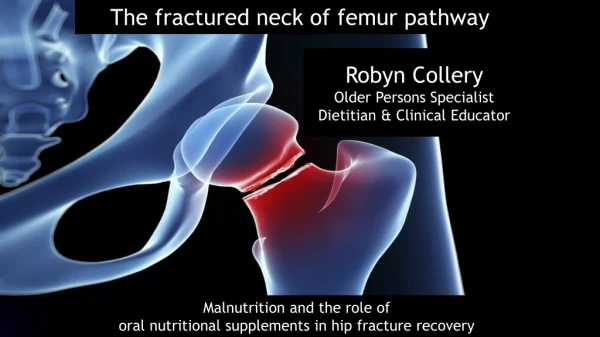 The fractured neck of femur pathway