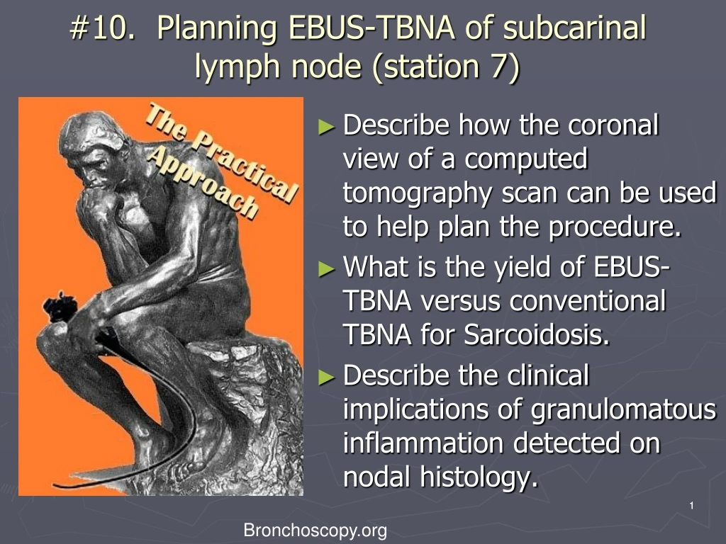 10 planning ebus tbna of subcarinal lymph node station 7