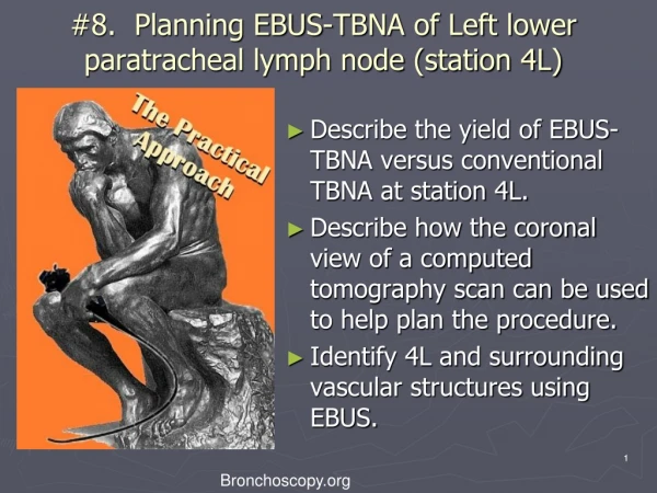 #8. Planning EBUS-TBNA of Left lower paratracheal lymph node (station 4L)