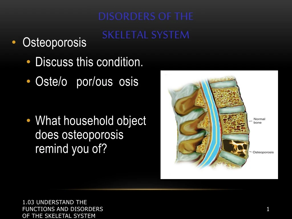disorders of the skeletal system
