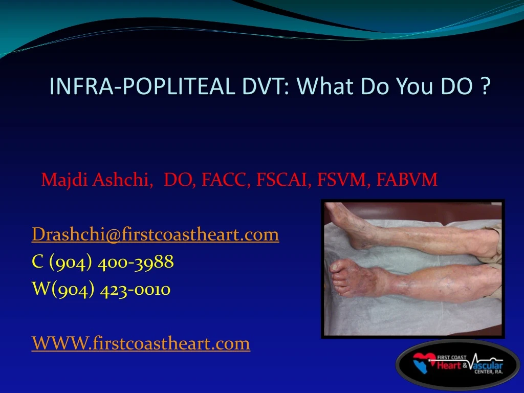 infra popliteal dvt what do you do