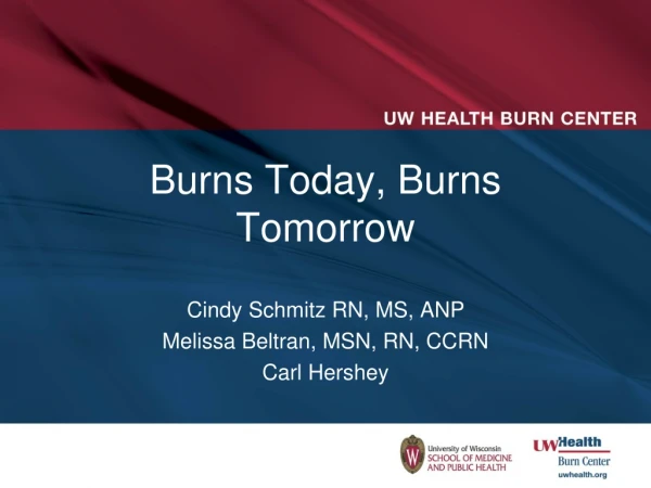 Burns Today, Burns Tomorrow
