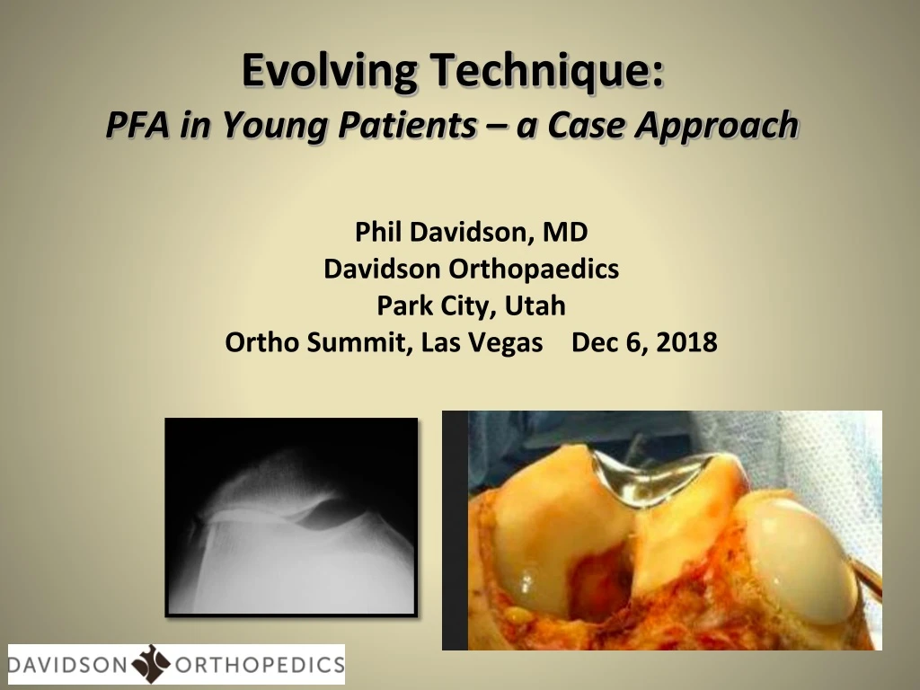 evolving technique pfa in young patients a case approach