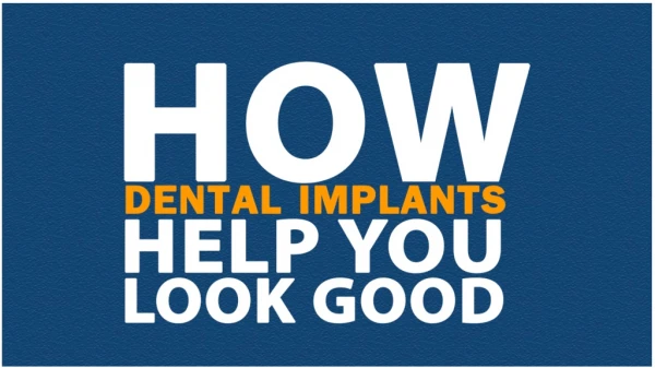 How dental implants help you look good