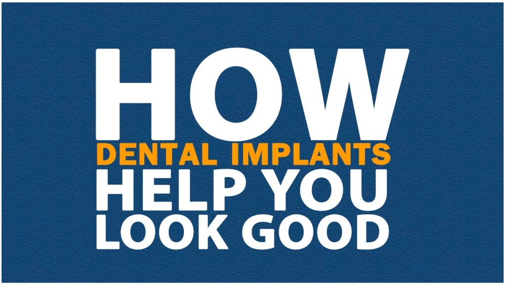 how dental implants help you look good