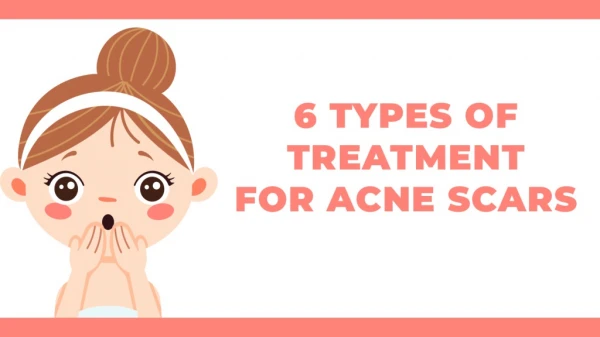 6 Types of Treatment for Acne Scars