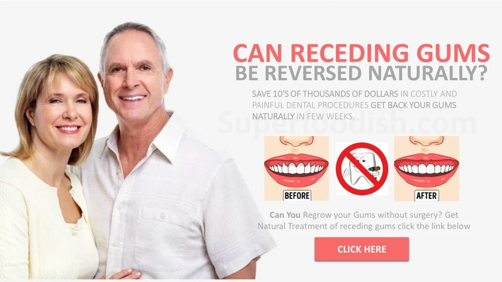 can receding gums be reversed naturally save