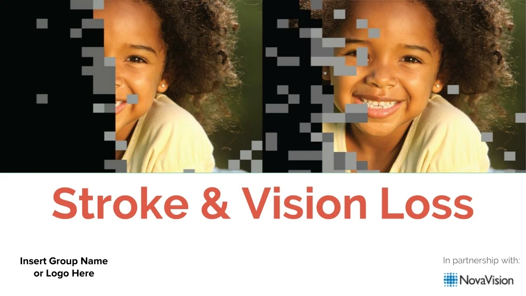 stroke vision loss