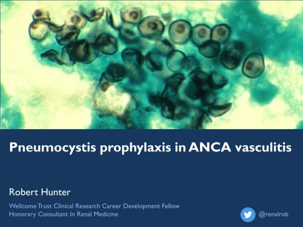 Pneumocystis prophylaxis in ANCA v asculitis Robert Hunter
