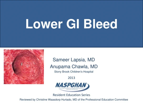 Lower GI Bleed