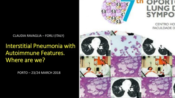 Interstitial Pneumonia with Autoimmune Features. Where are we?