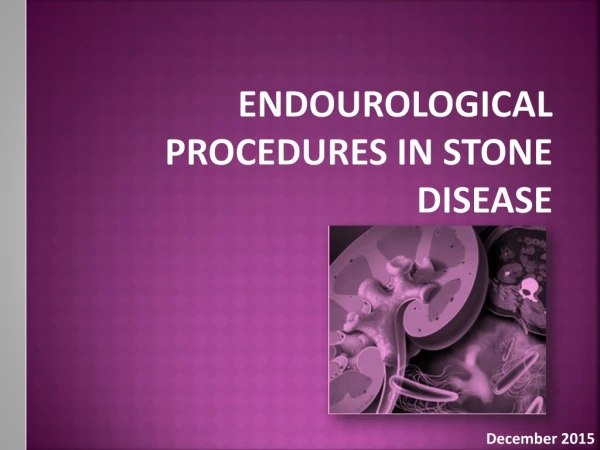 Endourological procedures in stone disease