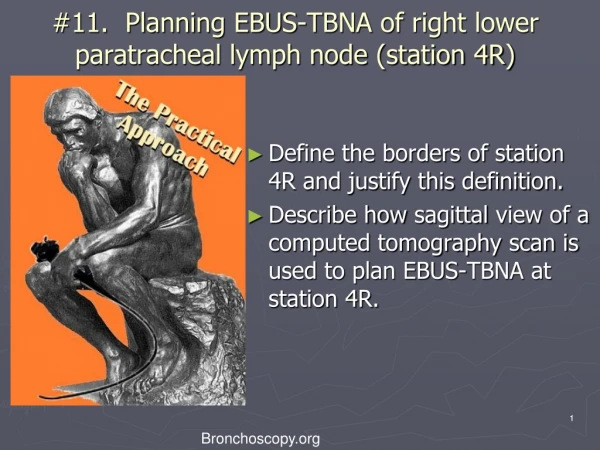 #11. Planning EBUS-TBNA of right lower paratracheal lymph node (station 4R)