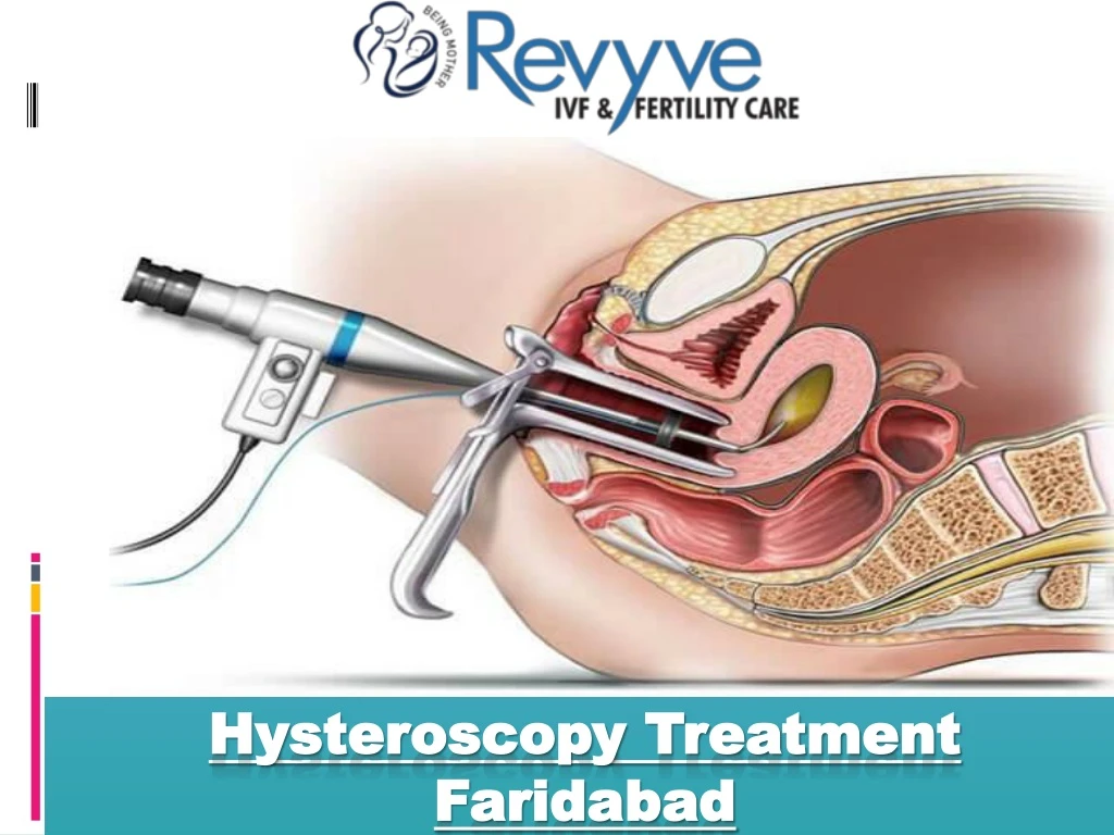 hysteroscopy treatment faridabad