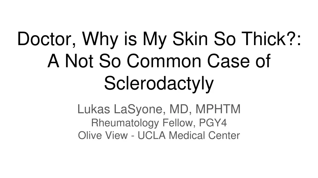 doctor why is my skin so thick a not so common case of sclerodactyly