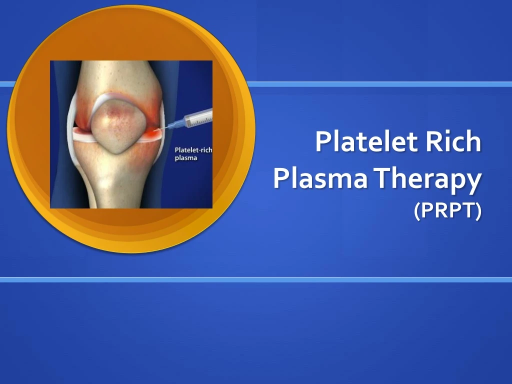 platelet rich plasma therapy prpt