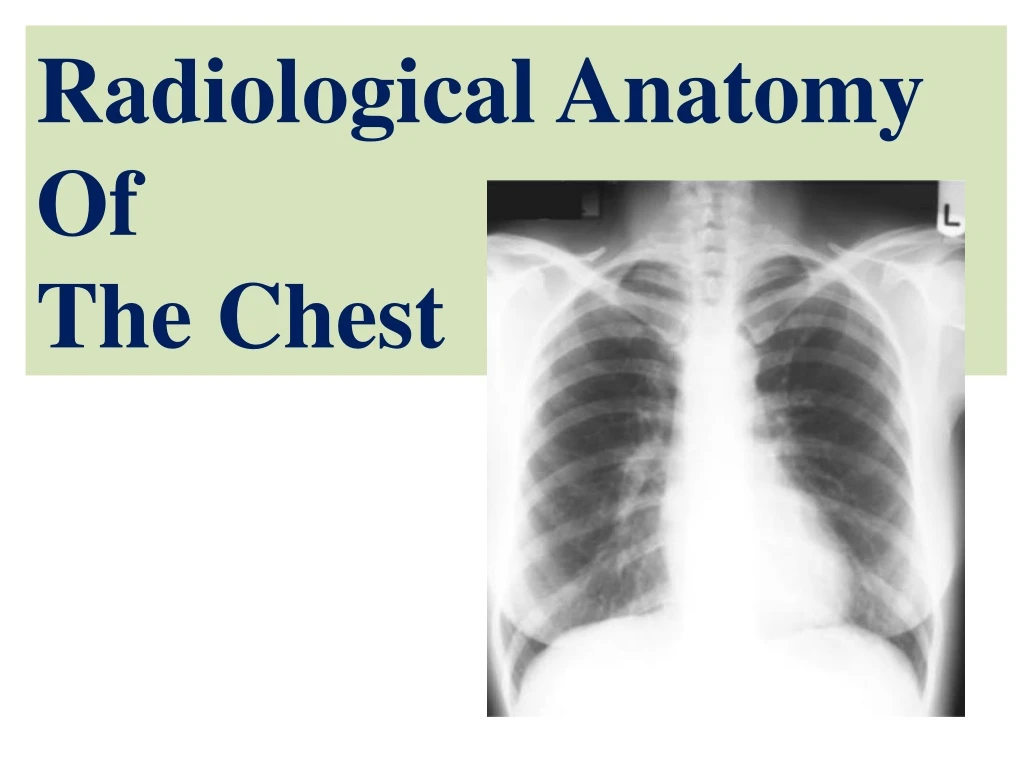 radiological anatomy of the chest