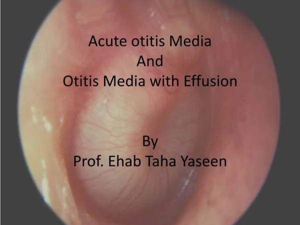 Acute otitis Media And Otitis Media with Effusion By Prof. Ehab Taha Yaseen