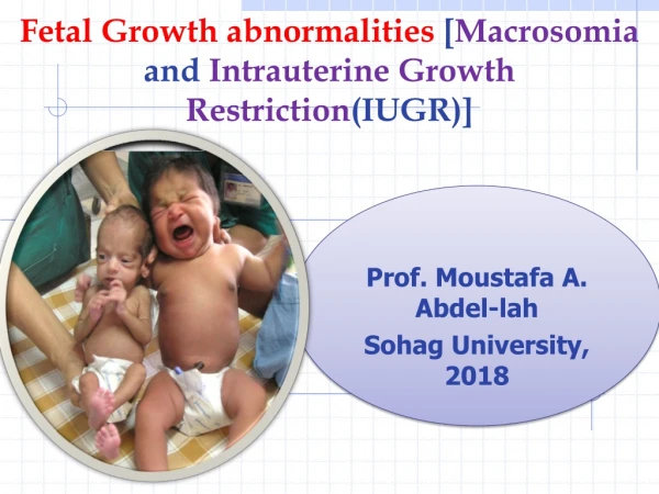 Fetal Growth abnormalities [ Macrosomia and Intrauterine Growth Restriction (IUGR)]