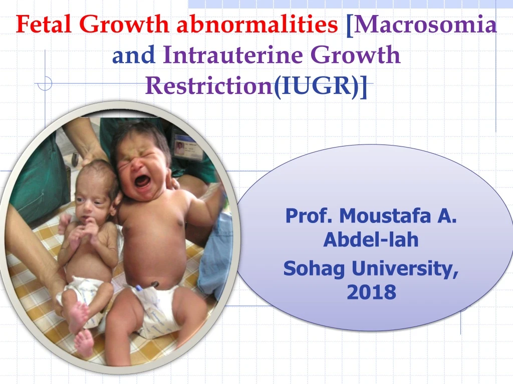 fetal growth abnormalities macrosomia and intrauterine growth restriction iugr