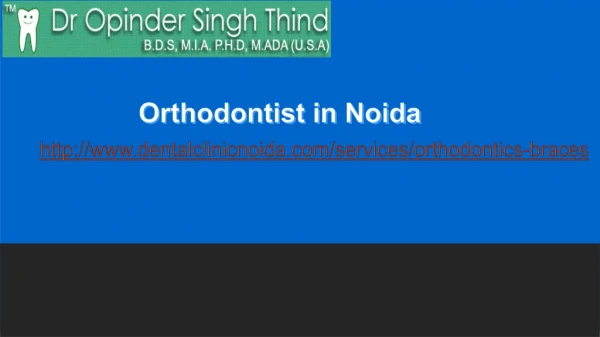 Orthodontist in Noida