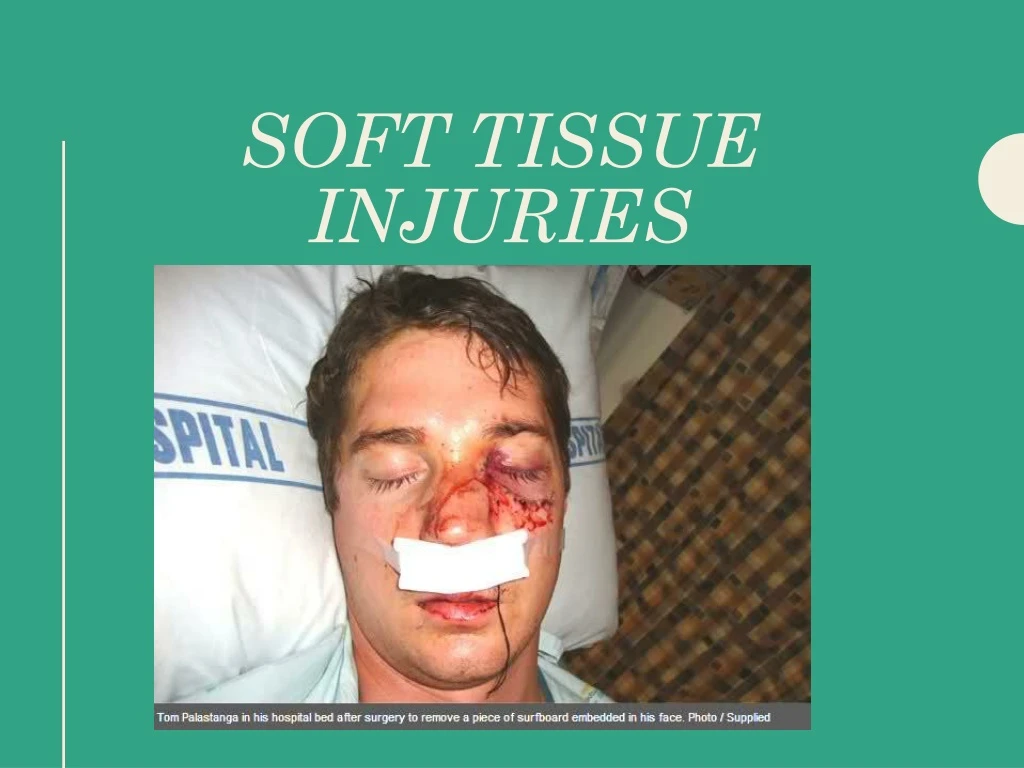 soft tissue injuries