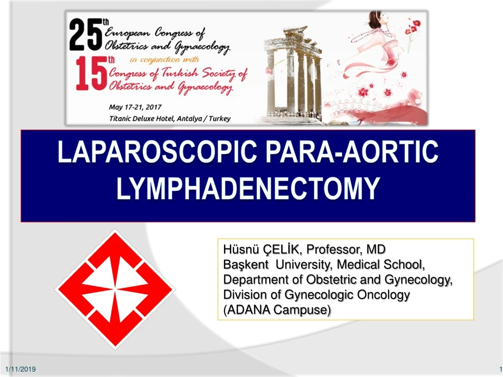 laparoscopic para aortic lymphadenectomy