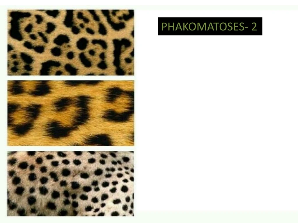 phakomatoses 2