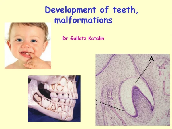 Development of teeth, malformations Dr Gallatz Katalin