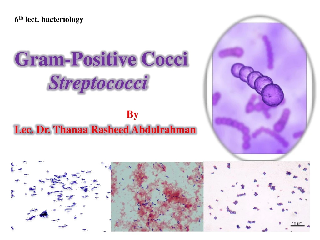 gram positive cocci streptococci