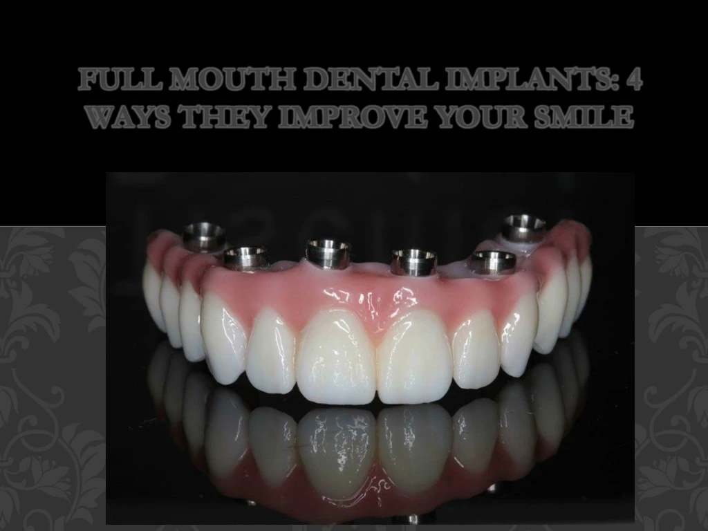 full mouth dental implants 4 ways they improve your smile