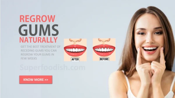 Recessed Gums Grow Back