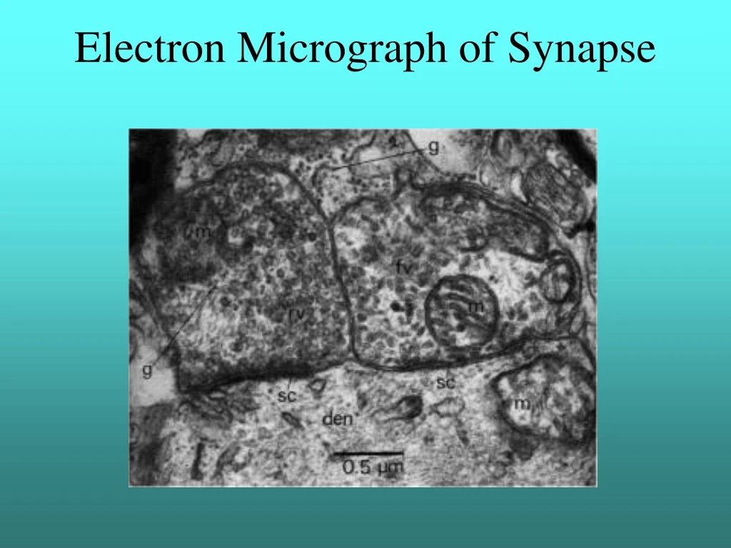 electron micrograph of synapse