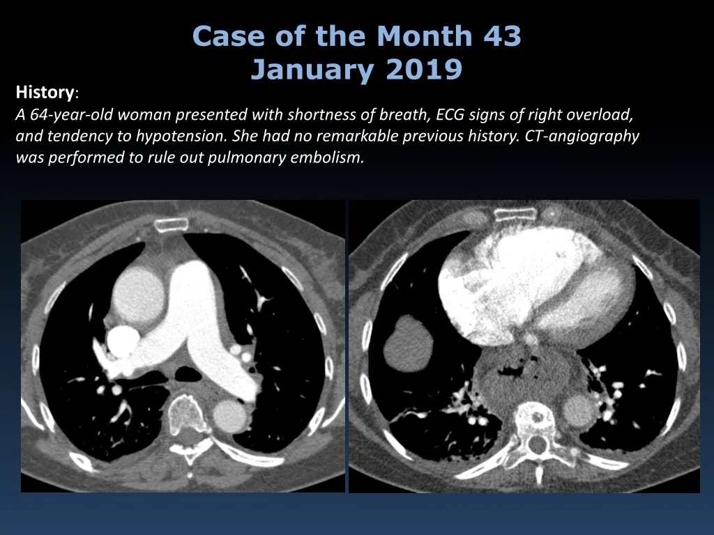 case of the month 43 january 2019