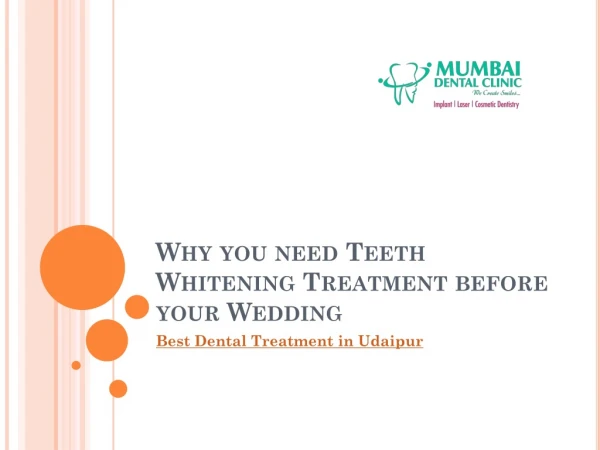 Why you need Teeth Whitening Treatment before your Wedding