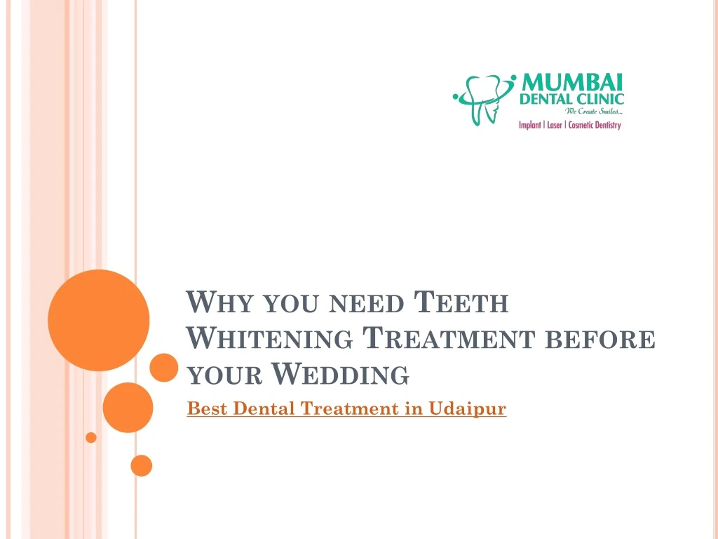 why you need teeth whitening treatment before your wedding