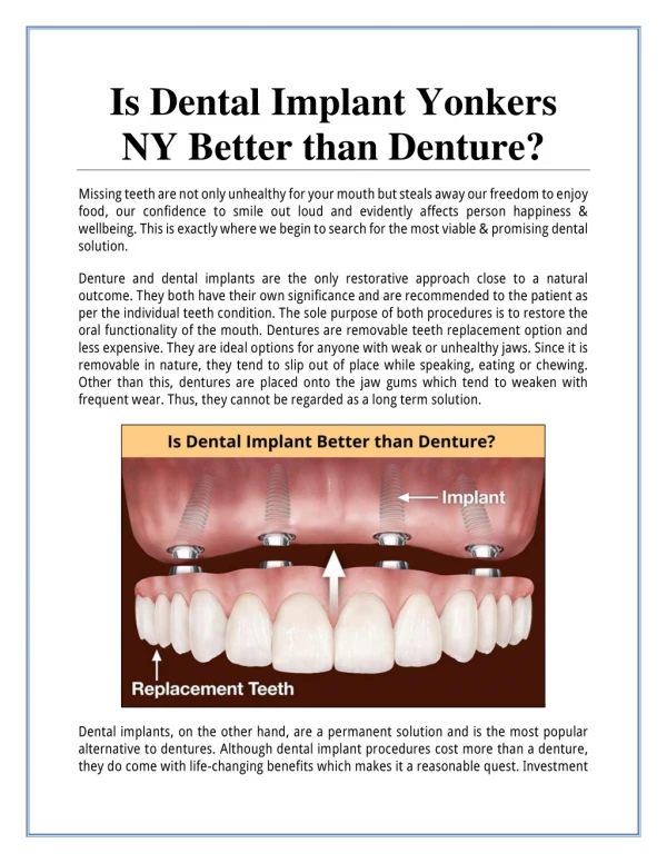 Is Dental Implant Yonkers NY Better than Denture?
