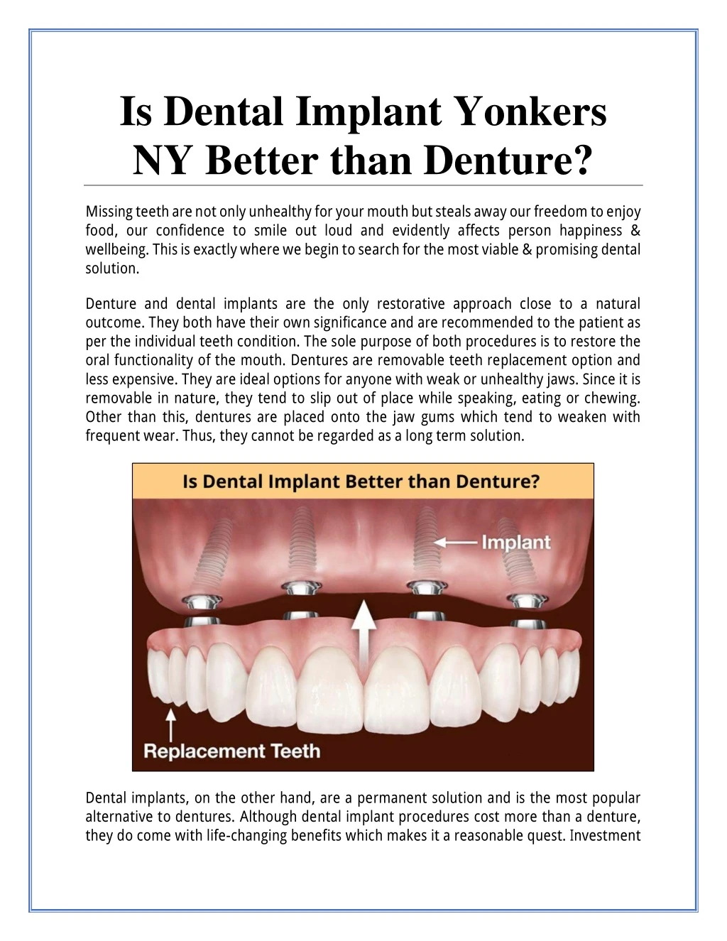 is dental implant yonkers ny better than denture