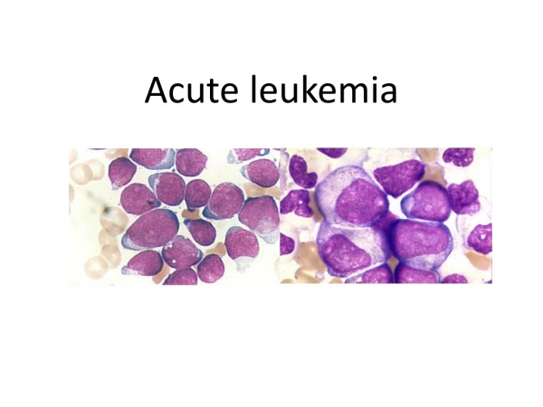 Acute leukemia