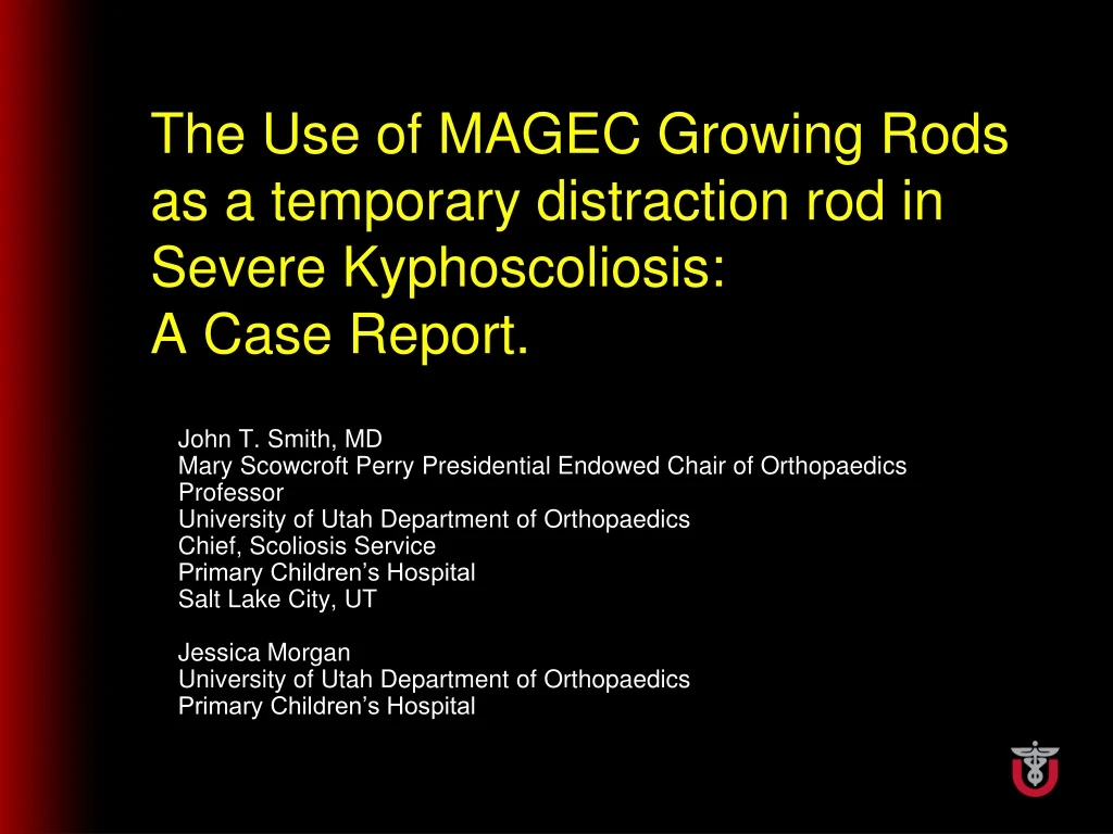 the use of magec growing rods as a temporary distraction rod in severe kyphoscoliosis a case report