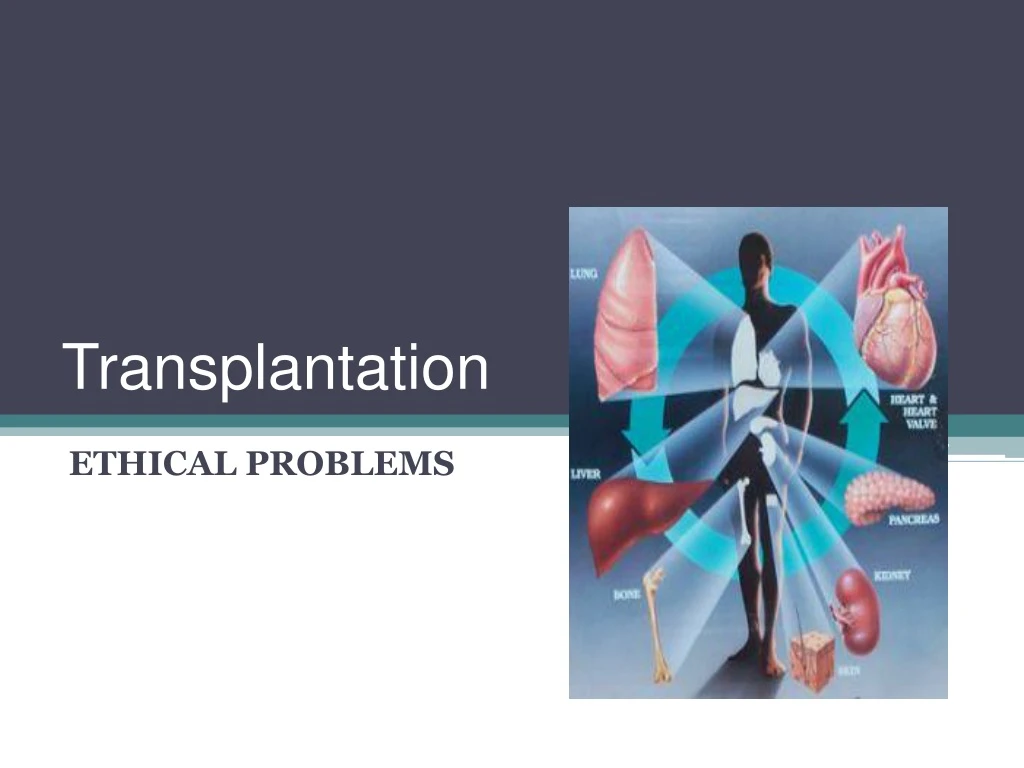 transplantation