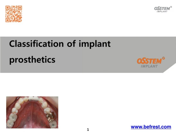 Classification of implant prosthetics