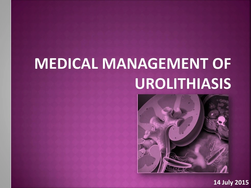 medical management of urolithiasis