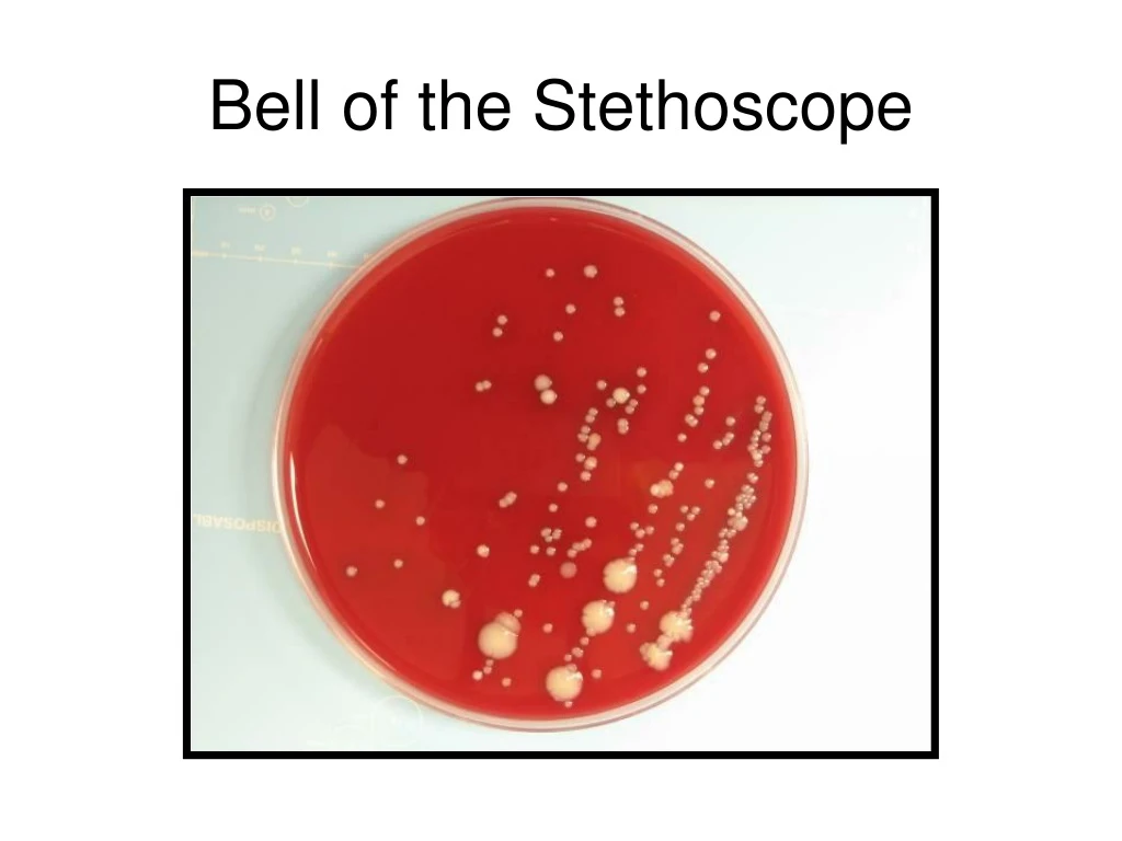 bell of the stethoscope