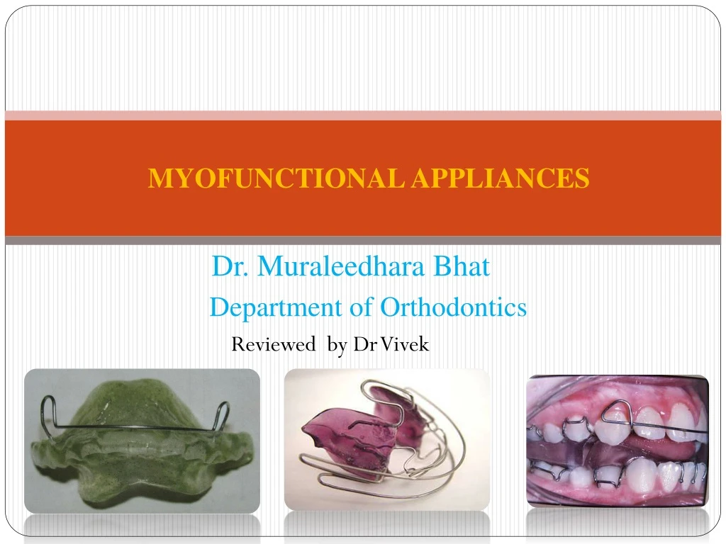 myofunctional appliances