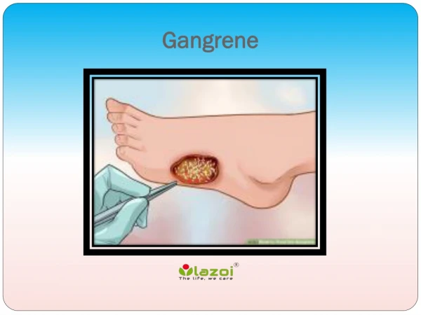 Gangrene