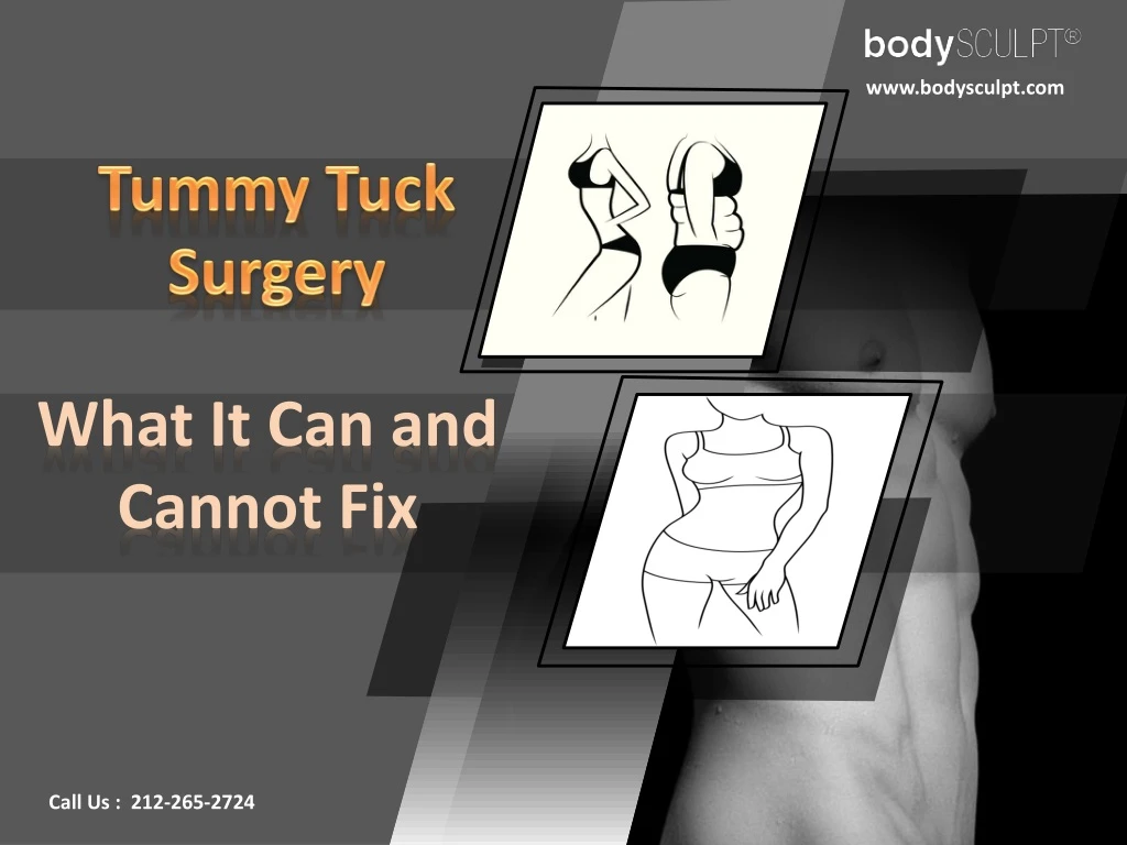 tummy tuck surgery