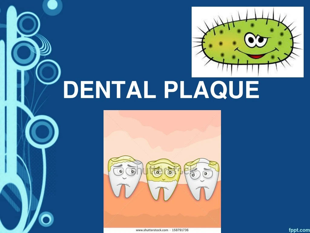 dental plaque