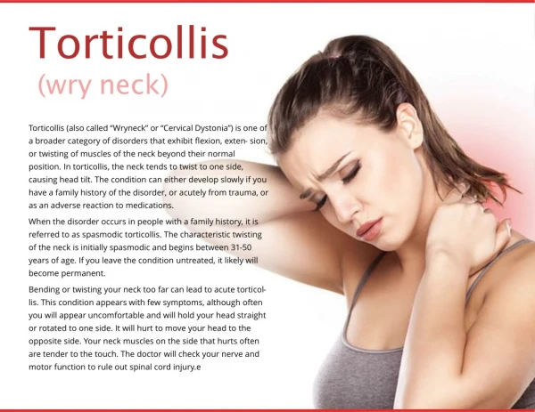 Torticollis ( wry neck )